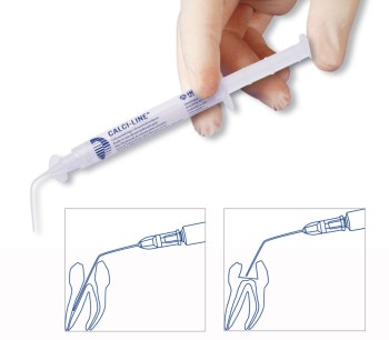 Calci-Line, gebrauchsfertige Calciumhydroxidpaste (45 %), mit 2-ml-Spritze und 5 Kanülen