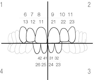 CoForm Matrizensystem Sortiment A oder B