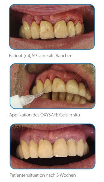 OXYSAFE Intro-Kit Professional