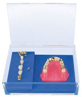 Zahnmodell PFM 16 mit 14 verschiedenen Zahnersatzformen